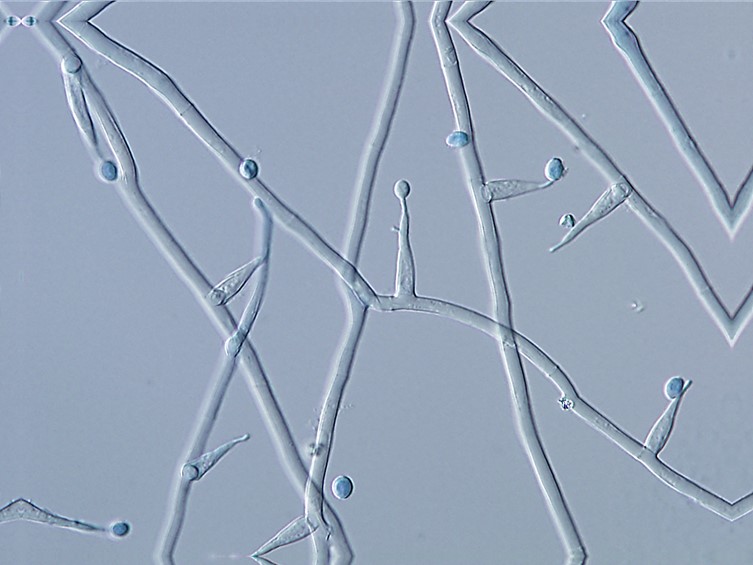 Ophiocordyceps khokpasiensis